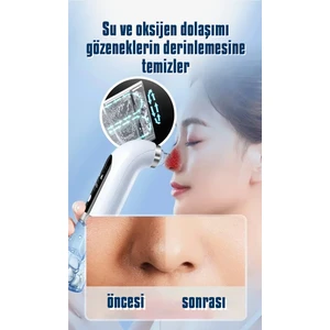 Yüz Temizleme Cihazı