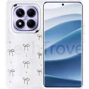 Xiaomi Redmi Note 14 Pro Plus Kılıf Airbag Tasarımlı Simli Şeffaf Zore Kutup Kapak