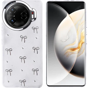Tecno Camon 30 Pro 5g Kılıf Kabartmalı Desenli Simli Şeffaf A+ Kalite Kapak