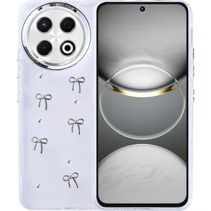 Tecno Spark 30 Pro Kılıf Airbag Tasarımlı Simli Şeffaf Sah Kutup Kapak - Fiyonk