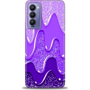 Tecno Camon 18P Kılıf Hd Baskılı Kılıf + Seramik Tam Kaplayan Ekran Koruyucu 421