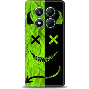 Xiaomi Redmi Note 14 Pro 5g Hd Baskılı Kılıf + Seramik Tam Kaplayan Ekran Koruyucu 360