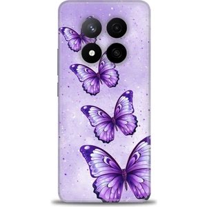 Xiaomi Redmi Note 14 Pro Plus Hd Baskılı Kılıf + Seramik Tam Kaplayan Ekran Koruyucu 296