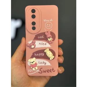 Honor 90 Uyumlu Kılıf Tasarımlı Desenli Kamera Korumalı Tavşan Pembe Yumuşak Silikon Kapak