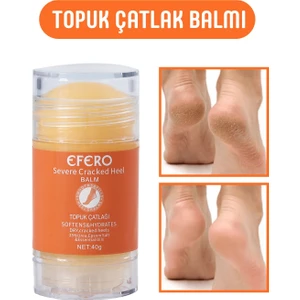 Tby Shop Kuru Ve Yıpranmış Ayaklar & Topuklar İçin Ayak Ve Topuk Kremi 40G