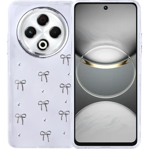 Tecno Spark 30 Kılıf Airbag Tasarımlı Simli Şeffaf Mkst Kutup Kapak - Fiyonk