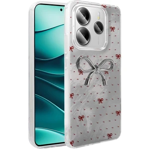 Redmi Note 14 5g Kılıf Kamera Korumalı Figürlü Mkst Ponti Silikon Kapak - Açık Mavi