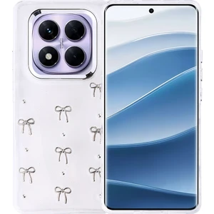 Redmi Note 14 Pro Plus Kılıf Airbag Tasarımlı Simli Şeffaf Mkst Kutup Kapak - Fiyonk