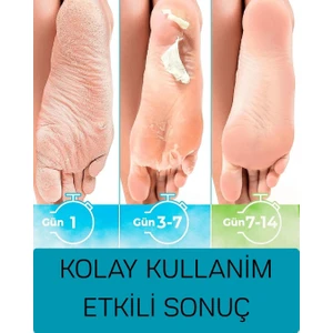 Bio Shoes Ayak Soyucu Peeling