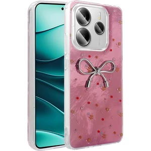 Redmi Note 14 5g Kılıf Kamera Korumalı Figürlü Kflg Ponti Silikon Kapak - Açık Pembe