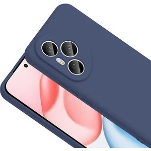 Ottonova Honor 400 Pro Kılıf Zore Mara Lansman Kapak