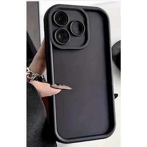 Realme C63 Kılıf Kamera Korumalı Ananas Silikon Kapak