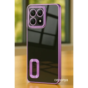 Xiaomi 14T Pro Kılıf Köşeleri Renkli Şeffaf Kamera Korumalı Silikon Luxury Kapak