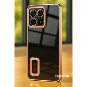 Xiaomi 14T Pro Kılıf Köşeleri Renkli Şeffaf Kamera Korumalı Silikon Luxury Kapak
