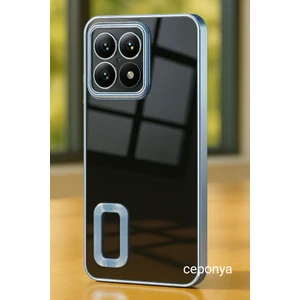 Xiaomi 14T Pro Kılıf Köşeleri Renkli Şeffaf Kamera Korumalı Silikon Luxury Kapak