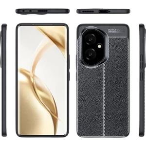 Honor 400 Uyumlu Silikon Kılıf Deri Desenli Darbe Emici Autofocus Tam Koruma Kapak