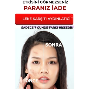 Leke Giderici Sérum BrightFix Series A200