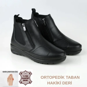 Tam Ortopedik Taban Hakiki Deri Kemik Çıkıntısı Anne Botu