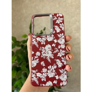 Infinix Hot 30I Kılıf Desenli Kamera Koruma Çıkıntılı Soft Tasarım Elde Kaymayan Kapak