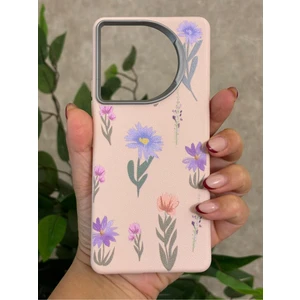 Tecno Camon 30 Kılıf Desenli Kamera Koruma Çıkıntılı Soft Tasarım Elde Kaymayan Kapak