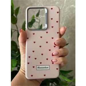 Xiaomi Redmi 13 Kılıf Desenli Kamera Koruma Çıkıntılı Soft Tasarım Elde Kaymayan Kapak