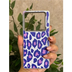 Infinix Note 40 Pro Kılıf Desenli Kamera Koruma Çıkıntılı Soft Tasarım Elde Kaymayan Kapak