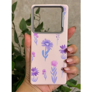 Infinix Note 40 Pro Kılıf Desenli Kamera Koruma Çıkıntılı Soft Tasarım Elde Kaymayan Kapak