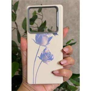 Infinix Note 40 Pro Kılıf Desenli Kamera Koruma Çıkıntılı Soft Tasarım Elde Kaymayan Kapak