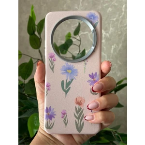 Xiaomi Redmi 14C Kılıf Desenli Kamera Koruma Çıkıntılı Soft Tasarım Elde Kaymayan Kapak