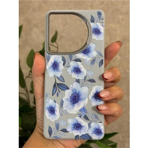 Tecno Camon 30 Kılıf Desenli Kamera Koruma Çıkıntılı Soft Tasarım Elde Kaymayan Kapak