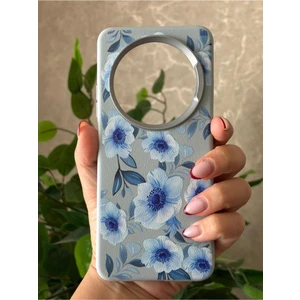 Xiaomi Redmi 14C Kılıf Desenli Kamera Koruma Çıkıntılı Soft Tasarım Elde Kaymayan Kapak