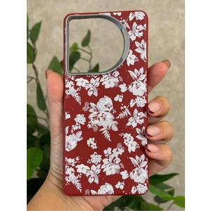 Tecno Camon 30 Kılıf Desenli Kamera Koruma Çıkıntılı Soft Tasarım Elde Kaymayan Kapak