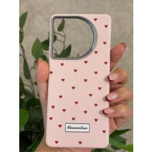 Tecno Camon 30 Kılıf Desenli Kamera Koruma Çıkıntılı Soft Tasarım Elde Kaymayan Kapak