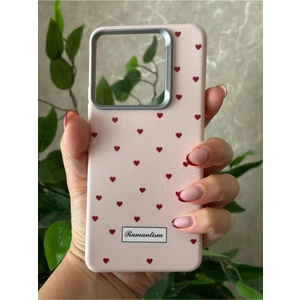 Xiaomi Redmi Note 14 4g Kılıf Desenli Kamera Koruma Çıkıntılı Soft Tasarım Elde Kaymayan Kapak