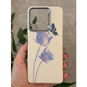 Infinix Hot 30 Kılıf Desenli Kamera Koruma Çıkıntılı Soft Tasarım Elde Kaymayan Kapak