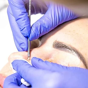 Mena Rise Galori Siyah Nokta Çıkarıcı Aracı Siyah Nokta Remover Sivilce Popper Sivilce Leke Için Araç Kiti Komedone Akne Zit Whitehead Yüz Çene Noze Alın Yanak Vücut