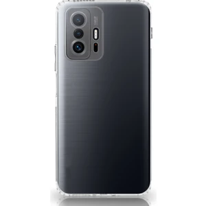 Caseart Xiaomi 11T ile Uyumlu Kapak Kamera Korumalı Şarj Yeri Tıpalı Şeffaf Silikon Kılıf