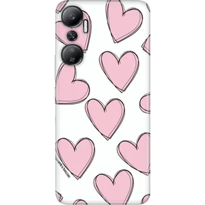 Infinix Hot 20 Kılıf Kamera Korumalı Silikon Resimli Uv Kapak Pembe Çizgili Kalpler