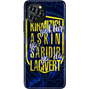 Oukitel C21 Pro Kılıf Silikon Desenli Resimli Uv Kapak Aşkın Rengi Sarı Lacivert