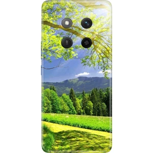 Honor X60 Pro - X9C 5g Kılıf Dekoratif Silikon Baskılı Kapak Mis Oksijen