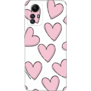 Xiaomi Redmi Note 12S Kılıf Kamera Korumalı Silikon Resimli Kapak Pembe Çizgili Kalpler