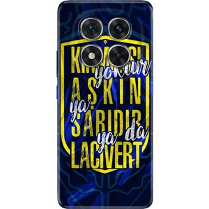 Xiaomi Redmi Note 15 Pro 5g Kılıf Art Silikon Baskılı Tpu Aşkın Rengi Sarı Lacivert