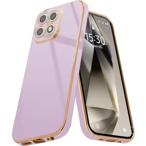 M.TK Moveteck Xiaomi Mi 14T Pro Kılıf Kamera Korumalı Parlak Gold Kenarlı Altın Işlemeli Şeritli Yumuşak Silikon Bark Kapak