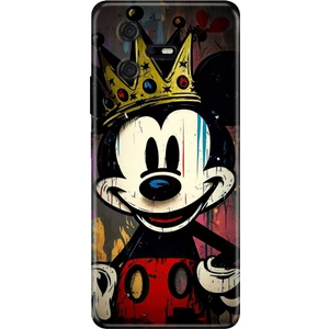 Casper Via A40 Kılıf Desenli Baskılı Tpu Rubber Kapak King-Mickey