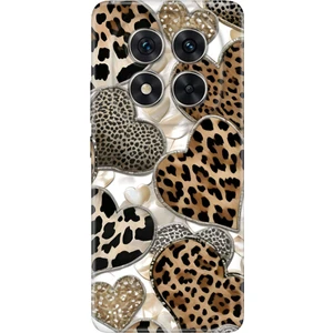 Xiaomi Redmi Note 15 Pro 5g Kılıf Desenli Baskılı Tpu Rubber Kapak Kalp 90210