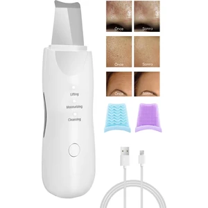 İndirim Sevinci Ultrasonik Yüz Temizleme Cihazı Scrubber | Siyah Nokta Akne Peeling Lifting Nemlendirme Aleti