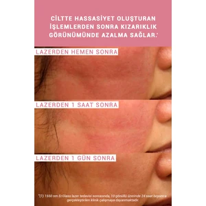 Etat Pur Enoxolone Pure Active Konsantre Bakım Ürünü 15 ml