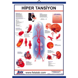 Hipertansiyon Eğitim Plakası