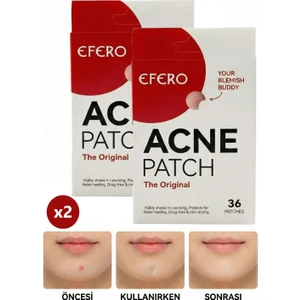 Akne Pimple Temizleme Bandı - Acne Pimple Patch 2 Adet 72 Patch