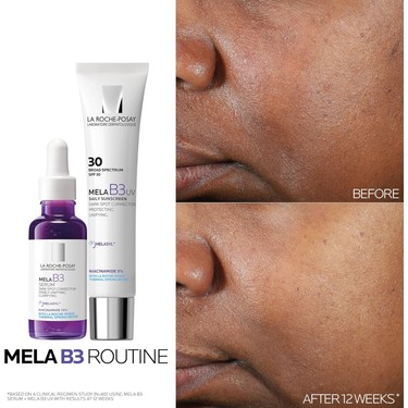 La Roche-Posay Roche Posay Mela B3 Koyu Leke Karşıtı Serum Fiyatı